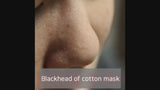 Ciracle Blackhead Off Cotton Mask 5ml*20