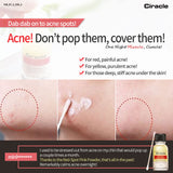 pimple drying lotion