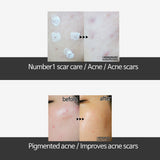 Ciracle Red Spot Zinc Niacinamide Cream 30ml